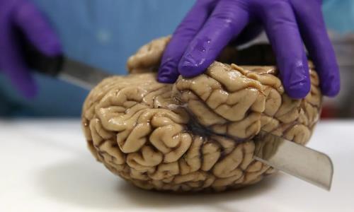 جزئی ترین تصویر از مغز انسان که تابه حال دیده اید!