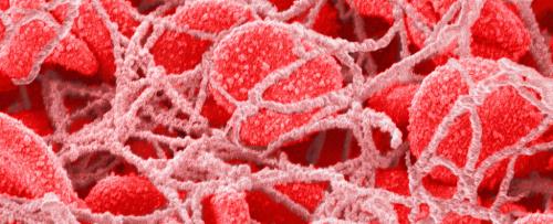 دست میکروپلاستیک ها در لخته شدن خون در کار است!